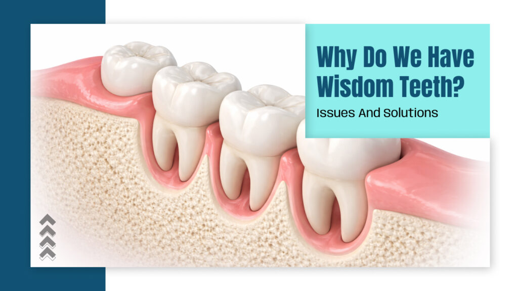 Why Do We Have Wisdom Teeth? Issues And Solutions