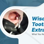 Wisdom Tooth Extraction