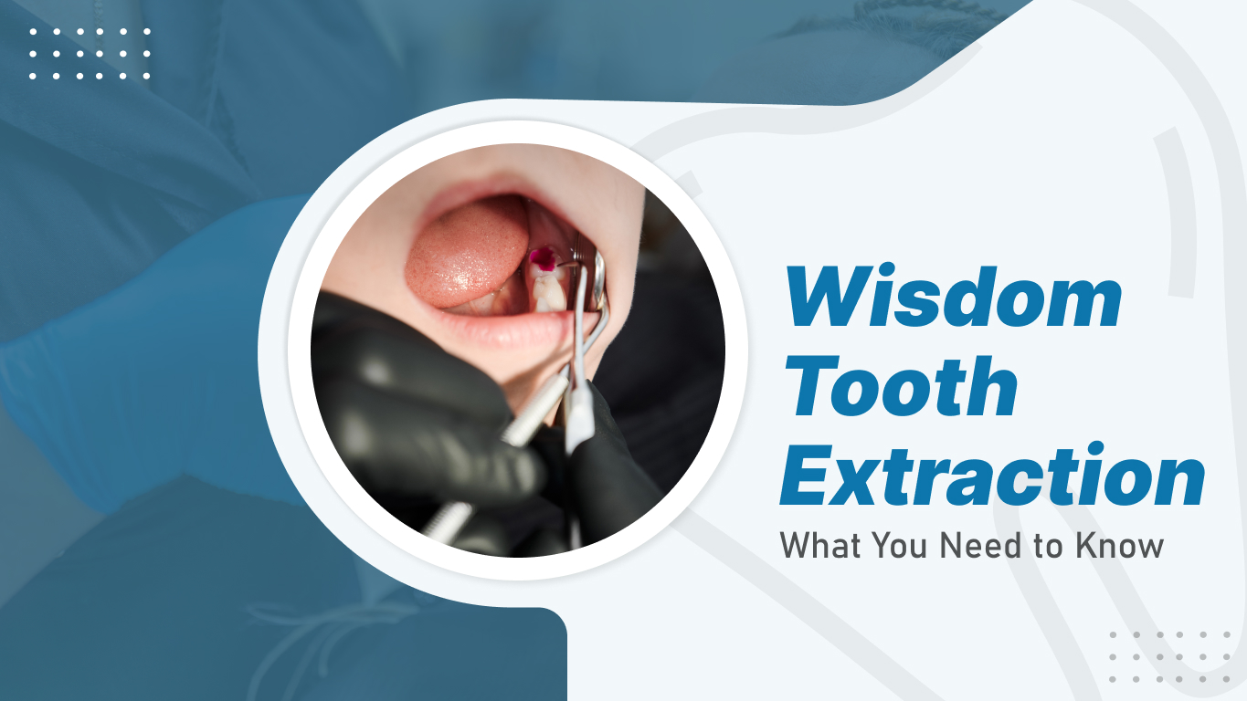 Wisdom Tooth Extraction
