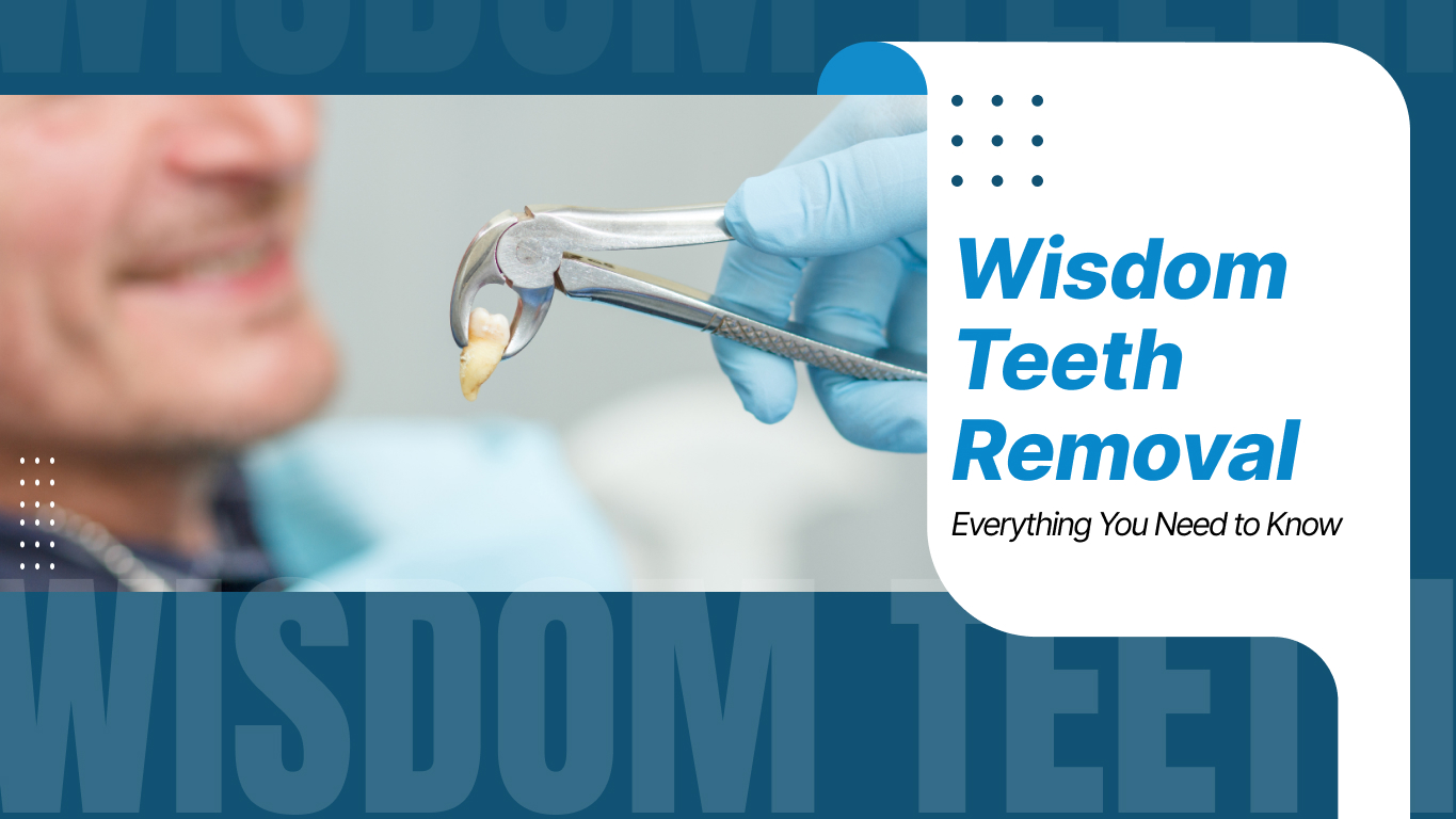 Wisdom Teeth Removal