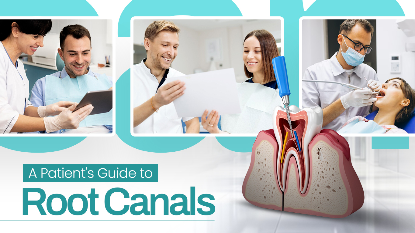 A Patients guide to Root Canals