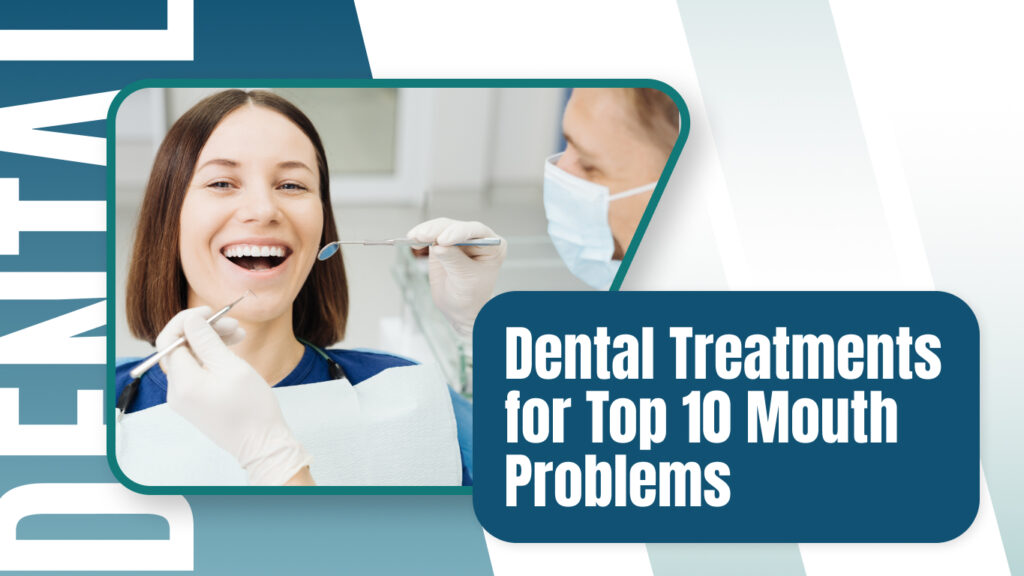 Dental Treatments for Top 10 Mouth Problems