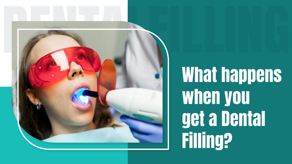 Dental Filling