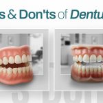 Dos _ Don'ts of Dentures