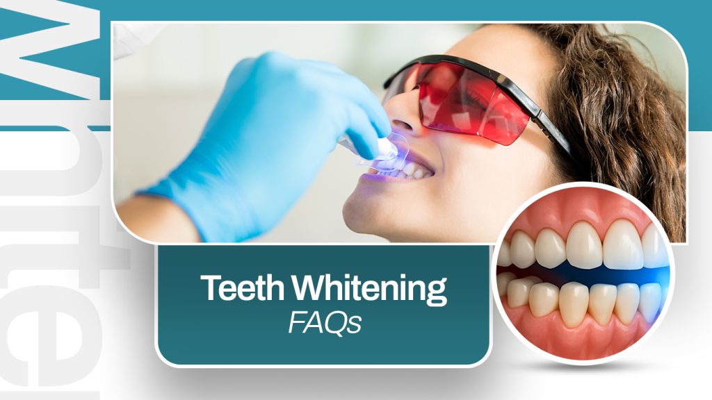 Teeth Whitening FAQs