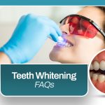 Teeth Whitening FAQs