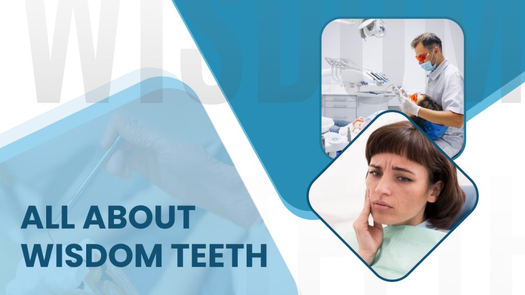 All About Wisdom Teeth