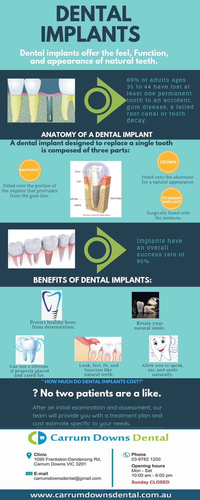 dental implant offer