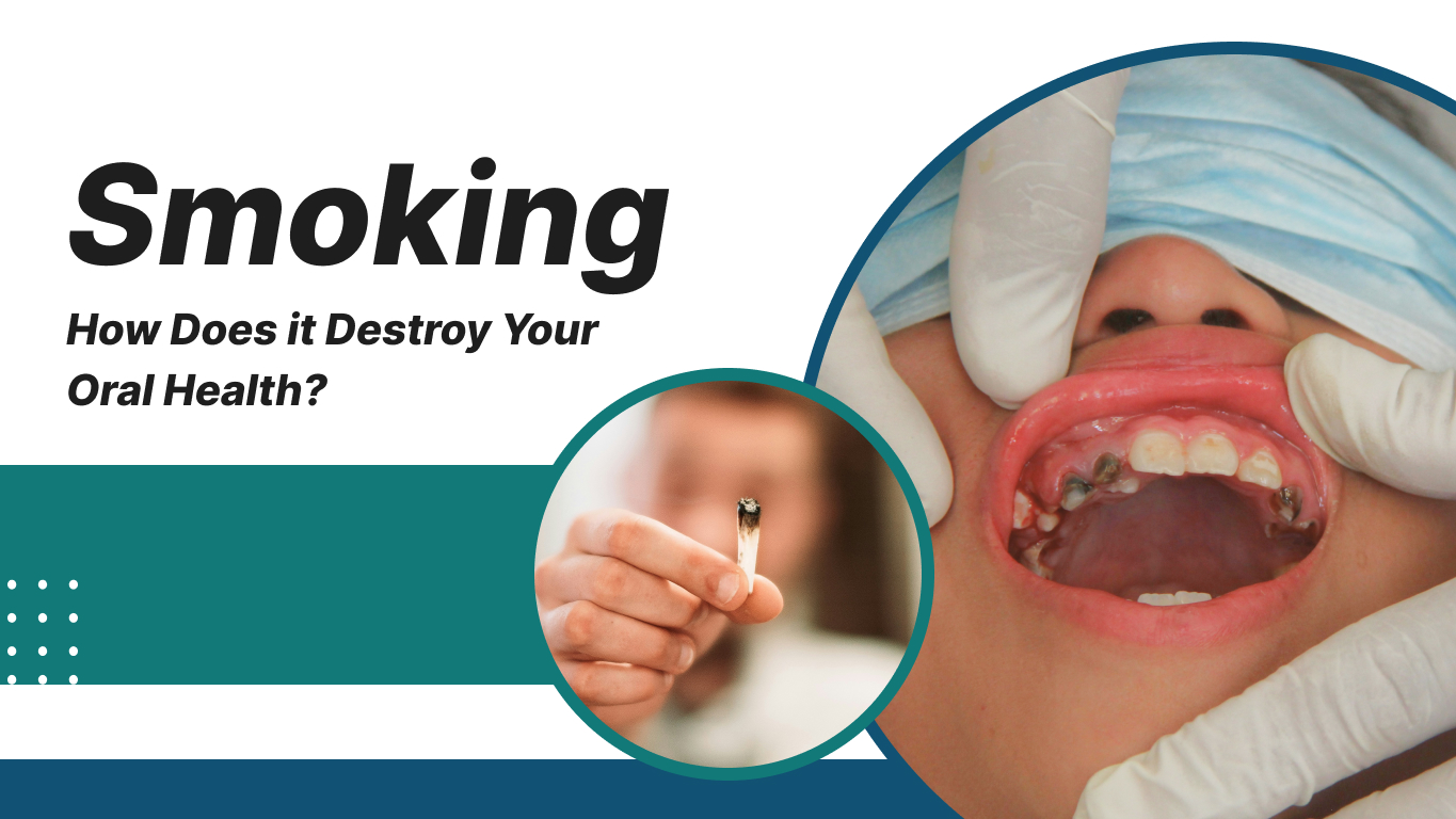 Smoking how does it destroy your oral health