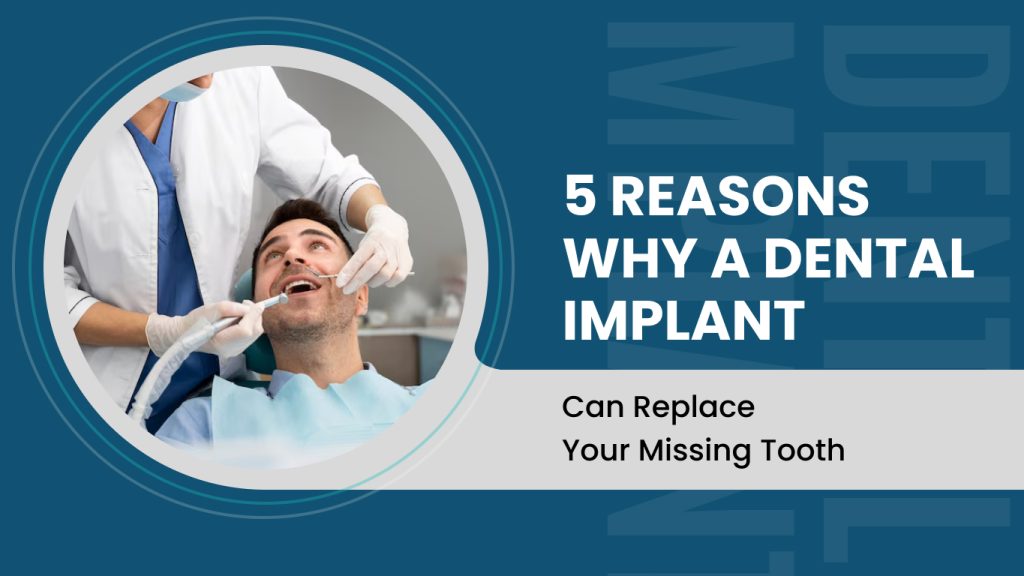 5 Reasons Why A Dental Implant Can Save Your Tooth