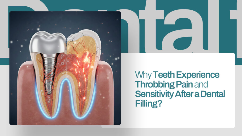 Why Teeth Experience Throbbing Pain and Sensitivity After a Dental Filling