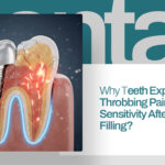 Why Teeth Experience Throbbing Pain and Sensitivity After a Dental Filling
