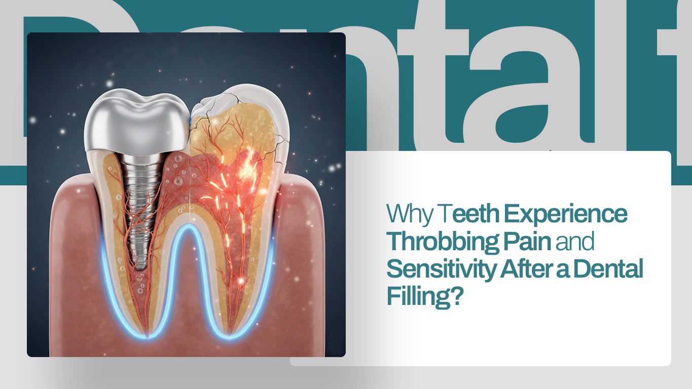 Why Teeth Experience Throbbing Pain and Sensitivity After a Dental Filling
