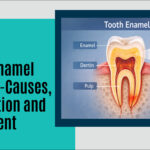Tooth Enamel