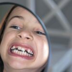 Do Cavities Cause Bad Breath? Causes and Treatment