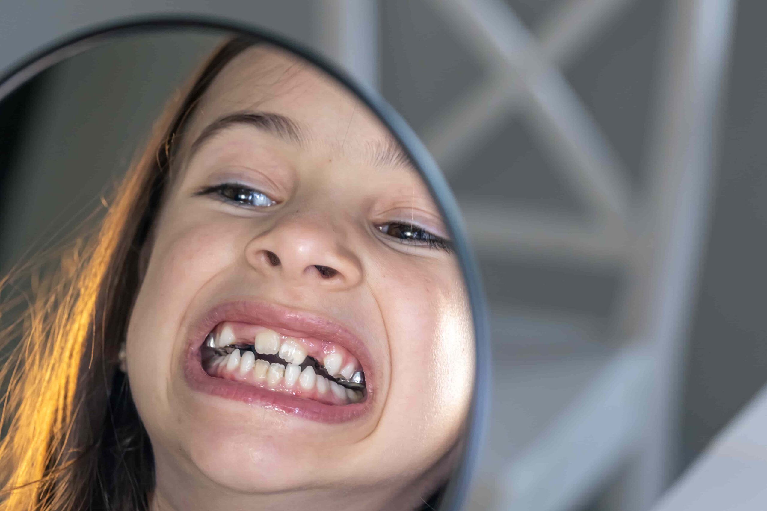 Do Cavities Cause Bad Breath? Causes and Treatment