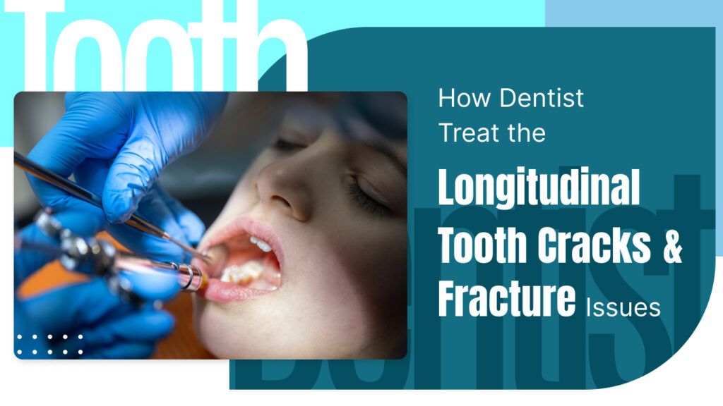 How dentist treat the longitudinal tooth cracks and fractures issue