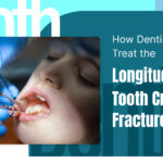 How dentist treat the longitudinal tooth cracks and fractures issue