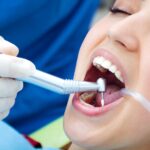 Getting A Tooth Pulled – What to expect during and after tooth extraction?