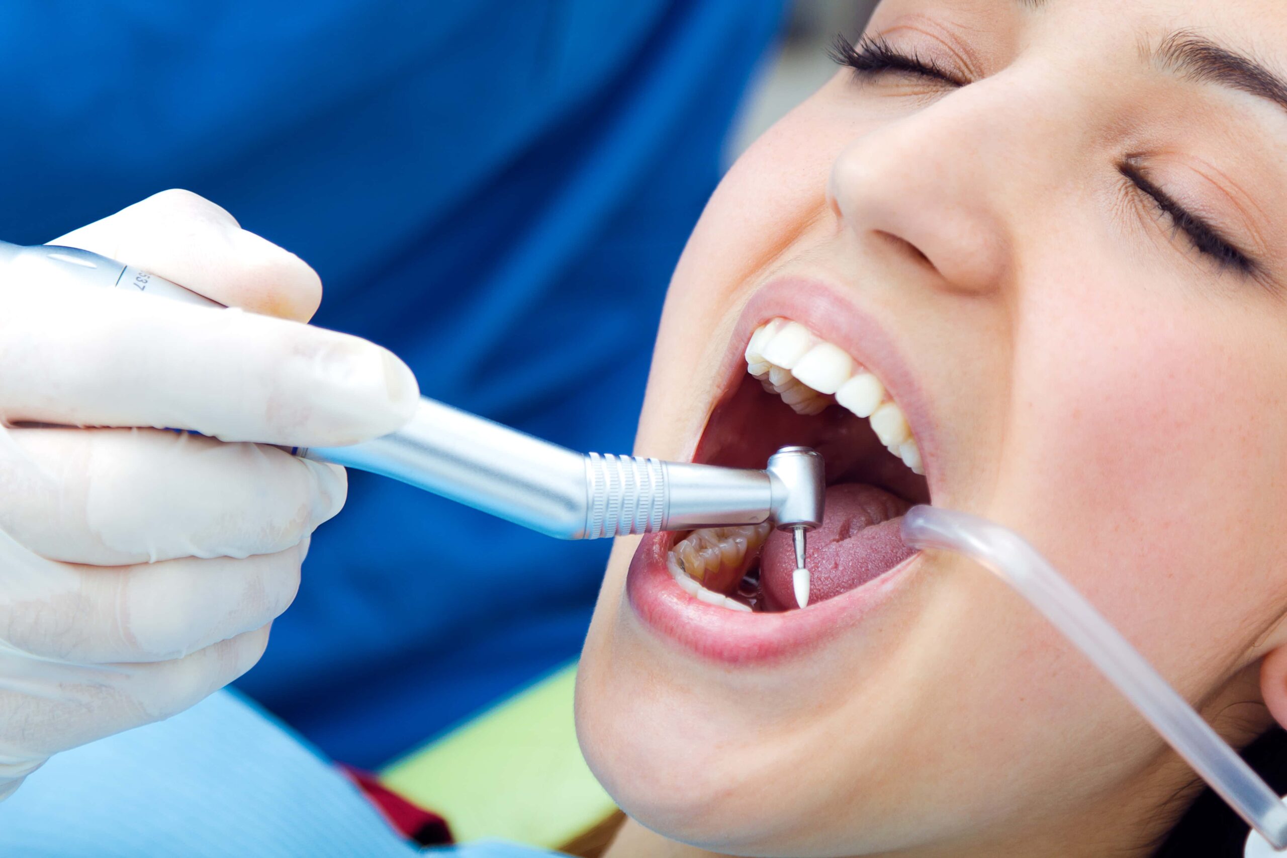 Getting A Tooth Pulled – What to expect during and after tooth extraction?