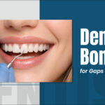 Dental Bonding