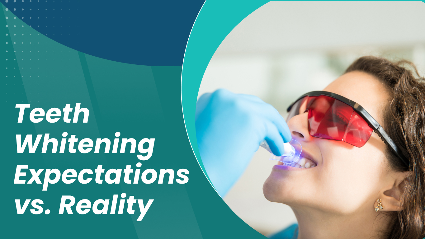 Teeth Whitening Expectations vs. Reality