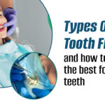 Type of tooth filling