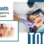 Dead Tooth: Signs, Symptoms, and Treatment
