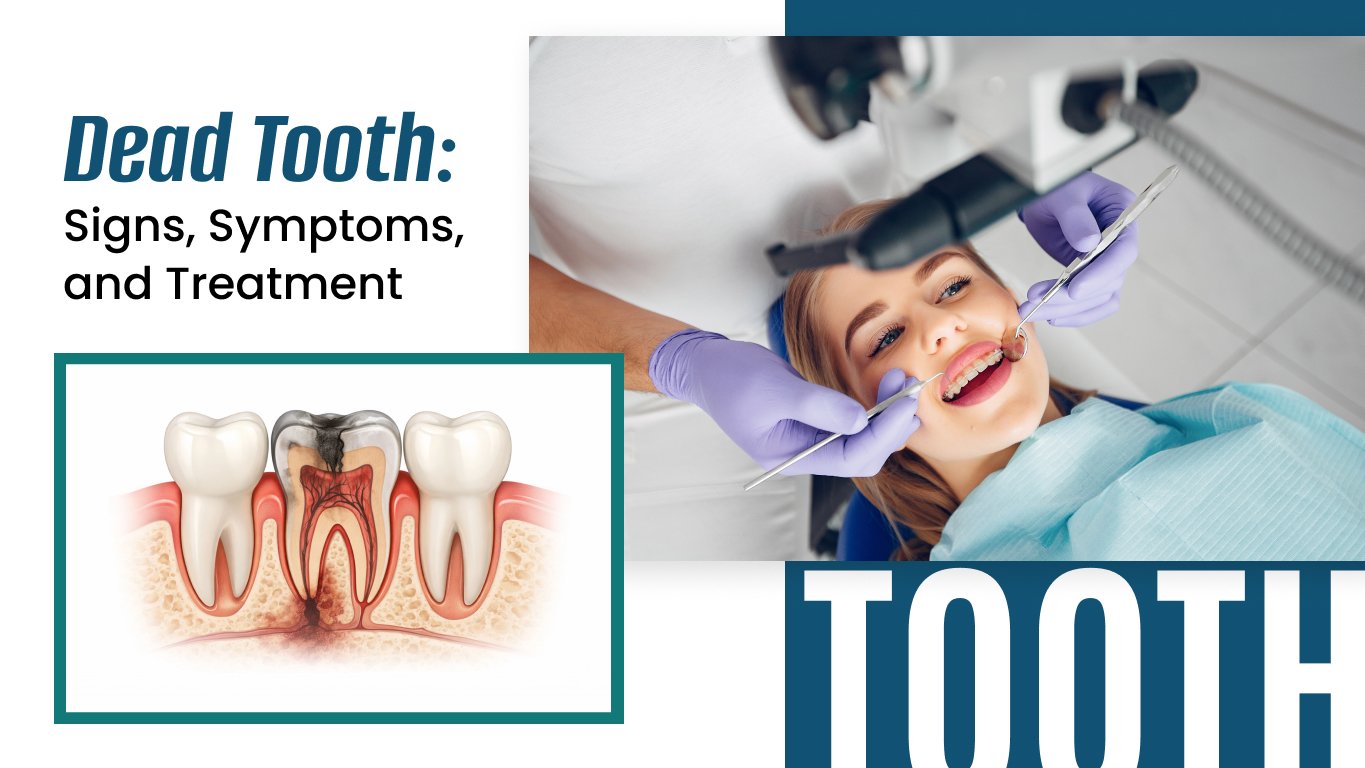 Dead Tooth: Signs, Symptoms, and Treatment