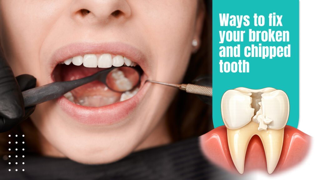 Ways to fix your broken and chipped tooth