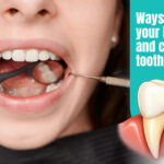 Ways to fix your broken and chipped tooth