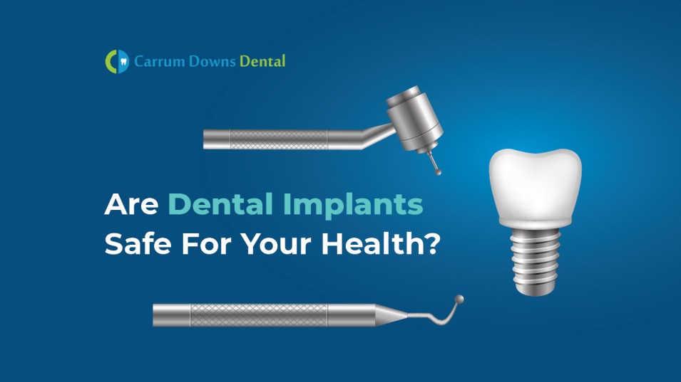 dental implant carrum downs dental
