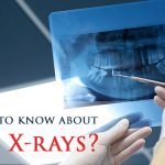 dentist checks x ray photo of mouth
