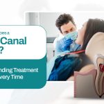 Root Canal