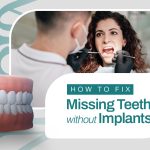 How to Fix Missing Teeth without Implants?