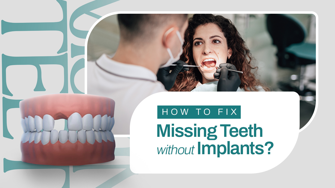 How to Fix Missing Teeth without Implants?