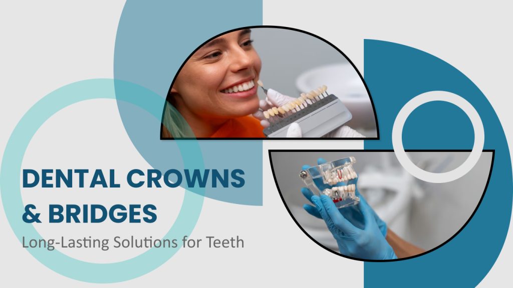 Dental Crowns