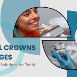 Dental Crowns