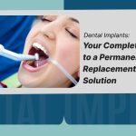 Dental-Implants