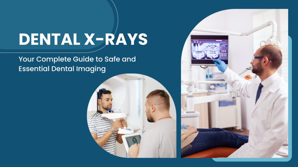 Dental X-rays