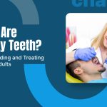 What Are Chalky Teeth? Understanding and Treating Them in Adults