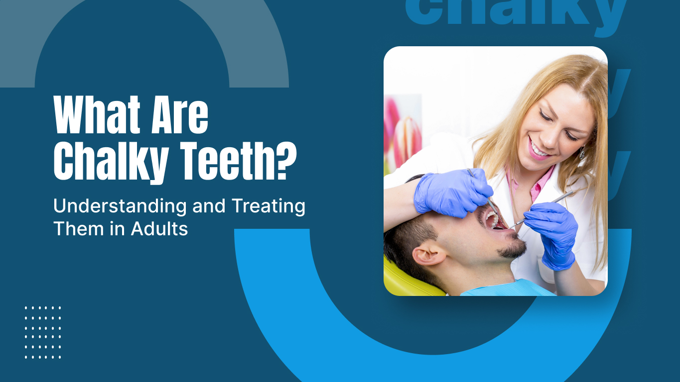 What Are Chalky Teeth? Understanding and Treating Them in Adults