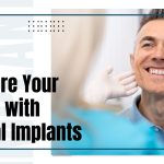 Dental implant