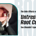 Untreated Root canal