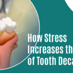 How Stress Increases the Risk of Tooth Decay