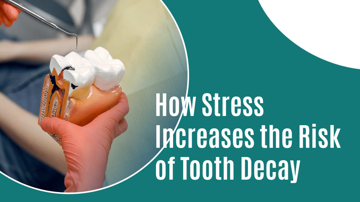 How Stress Increases the Risk of Tooth Decay