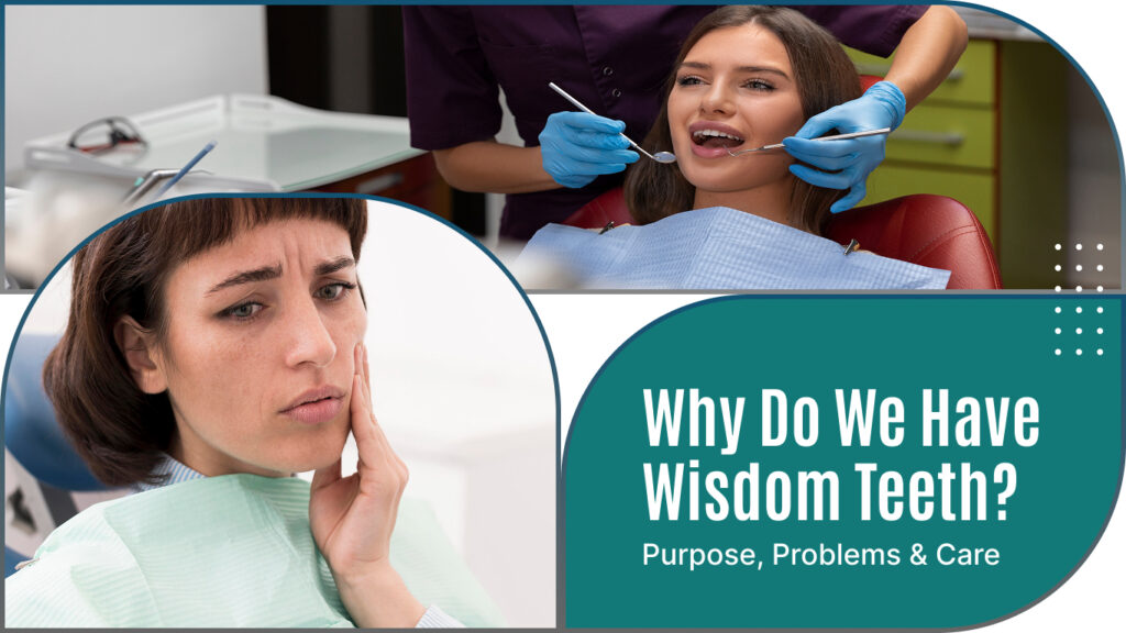 Why Do We Have Wisdom Teeth