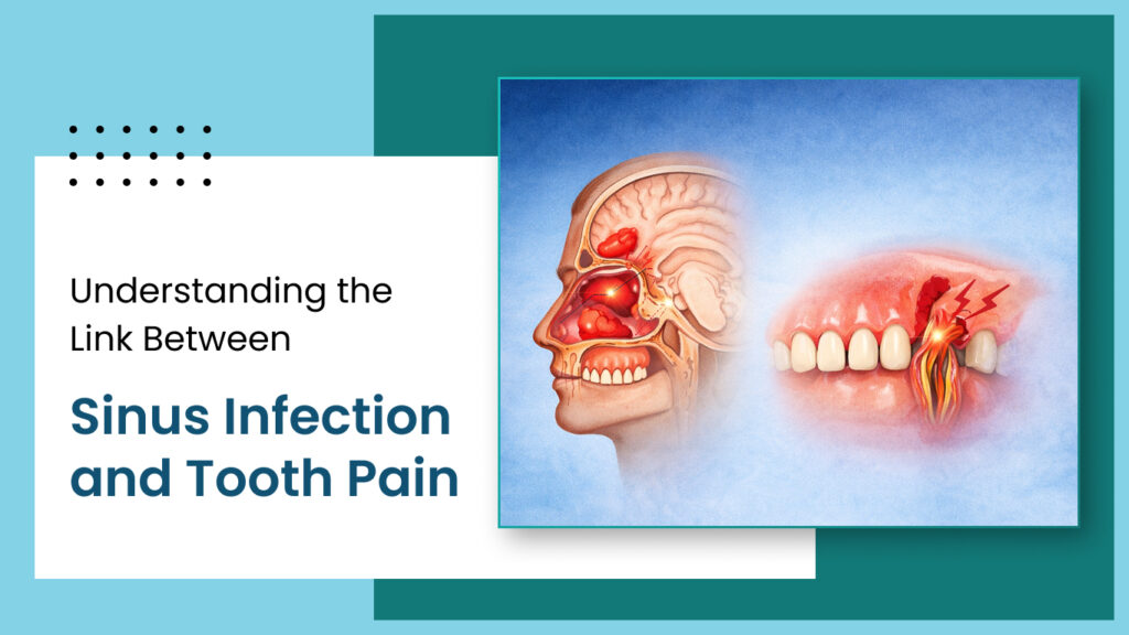 Understanding the Link Between Sinus Infection and Tooth Pain