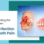 Understanding the Link Between Sinus Infection and Tooth Pain
