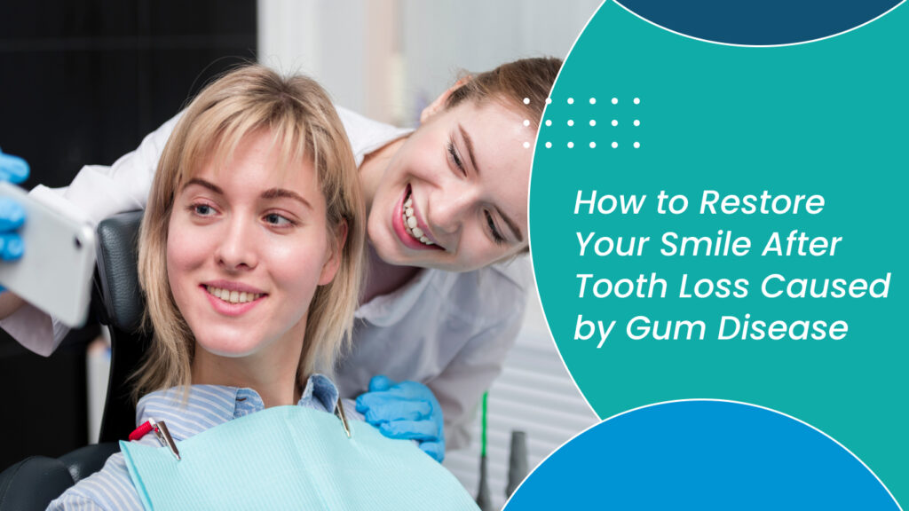 How to Restore Your Smile After Tooth Loss Caused by Gum Disease